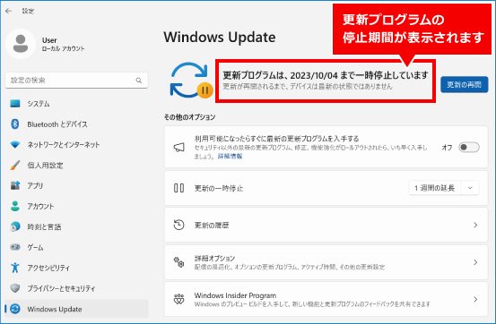 Windows Update（更新プログラム）を一時的に延期する方法 ③